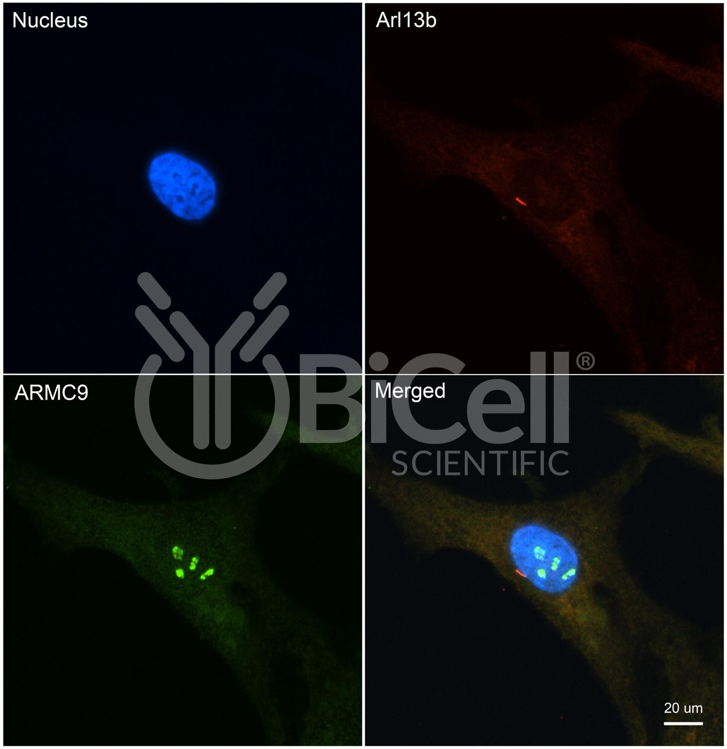 ARMC9 (Human) Antibody