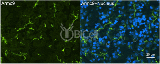 ARMC9 Antibody - FFPE Validated