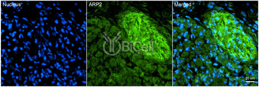 ACTR2 (ARP2) Antibody - Western Blot Validated