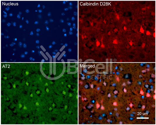AGTR2 (AT2) Antibody - Western Blot Validated