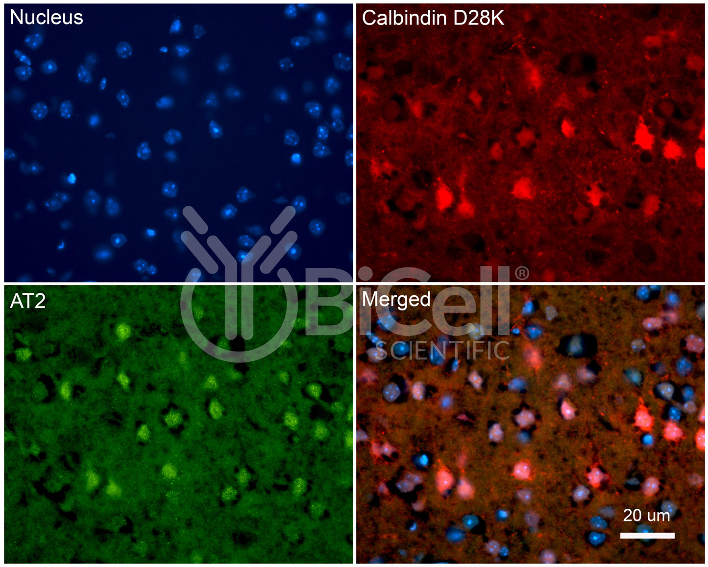 AGTR2 (AT2) Antibody - FFPE Validated