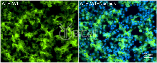 ATP2A1 (SERCA1) Antibody