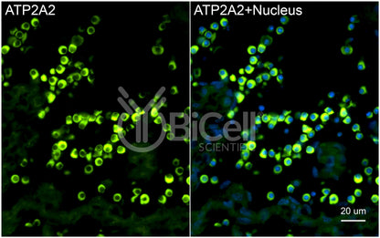 ATP2A2 (SERCA2) Antibody - FFPE Validated