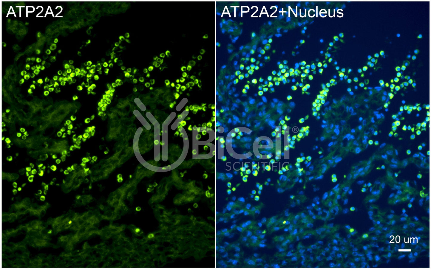 ATP2A2 (SERCA2) Antibody