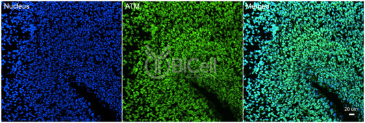 ATM Antibody