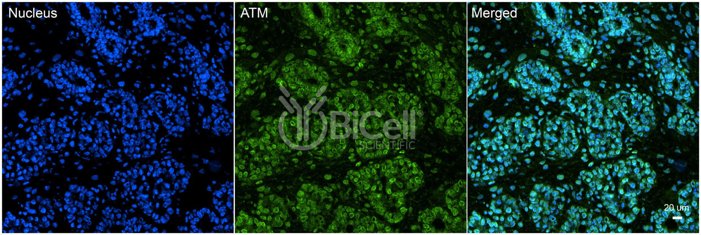 ATM Antibody - Western Blot Validated