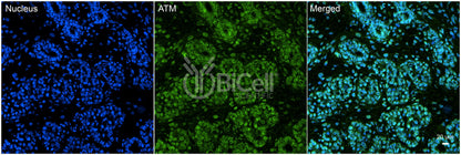 ATM Antibody - FFPE Validated