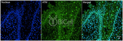 ATM Antibody - Western Blot Validated