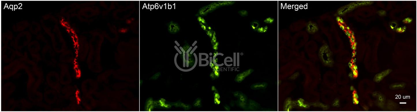 ATP6V1B1 (ATP6B1) Antibody - FFPE Validated