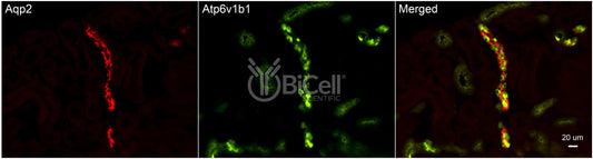 ATP6V1B1 (ATP6B1) Antibody - FFPE Validated