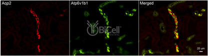 ATP6V1B1 (ATP6B1) Antibody