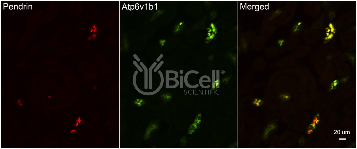 ATP6V1B1 (ATP6B1) Antibody - FFPE Validated