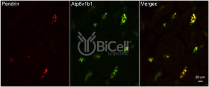 ATP6V1B1 (ATP6B1) Antibody - FFPE Validated