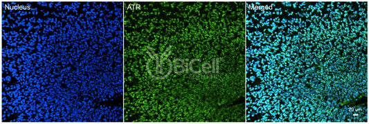 ATR Antibody - Western Blot Validated