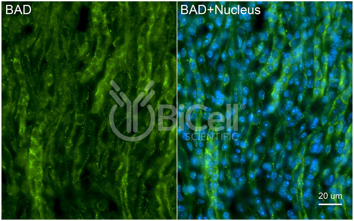 BAD (BCL2L8) Antibody - FFPE Validated