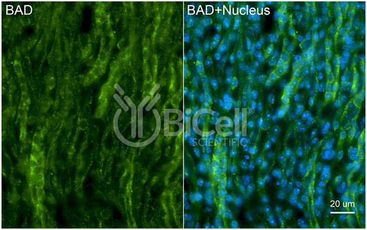 BAD (BCL2L8) Antibody - FFPE Validated