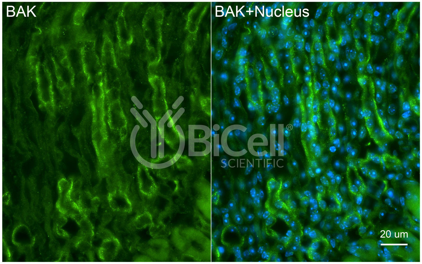 BAK (BAK1 or BCL2L7) Antibody - Western Blot Validated