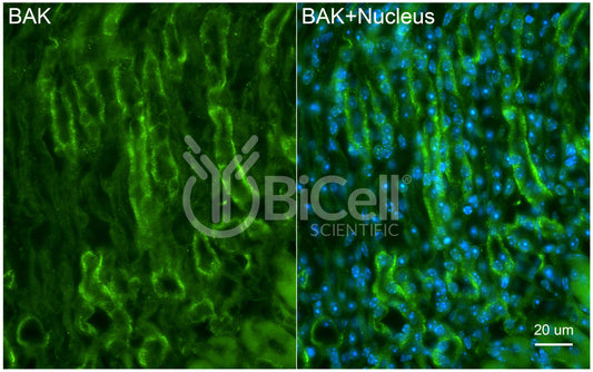 BAK (BAK1 or BCL2L7) Antibody - FFPE Validated