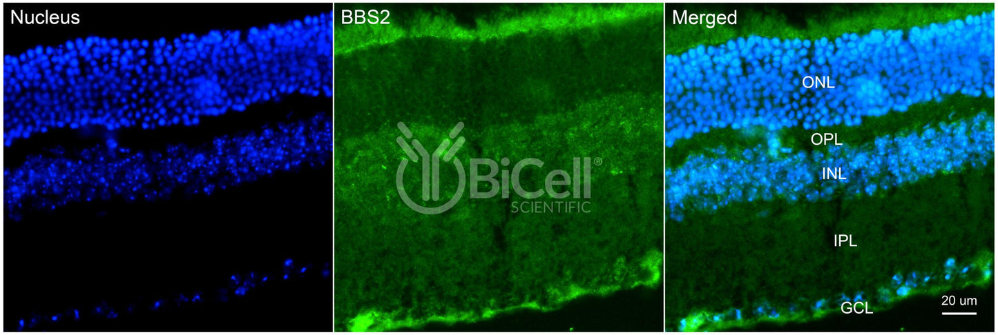 BBS2 Antibody