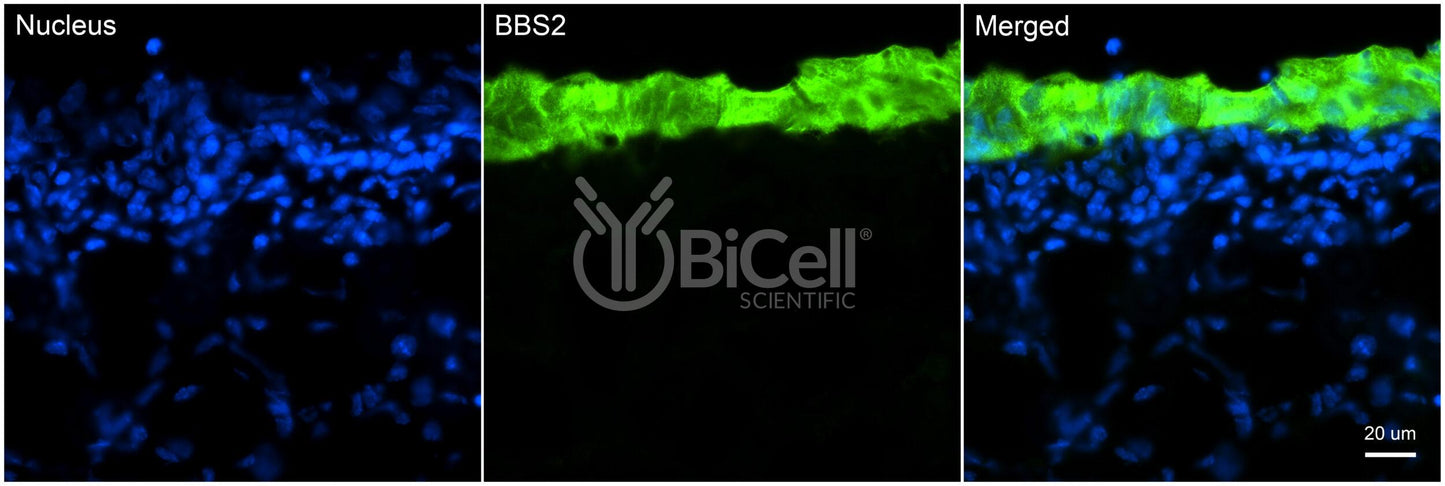 BBS2 Antibody - Western Blot Validated