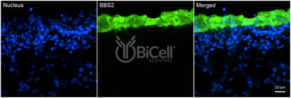 BBS2 Antibody