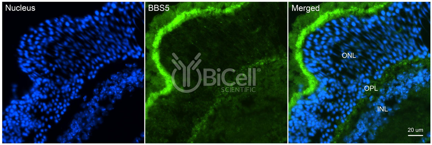 BBS5 (N-Terminus) Antibody - FFPE Validated