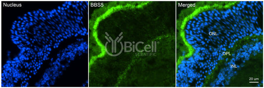 BBS5 (N-Terminus) Antibody - FFPE Validated