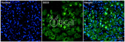 BBS9 (PTHB1) Antibody - FFPE Validated