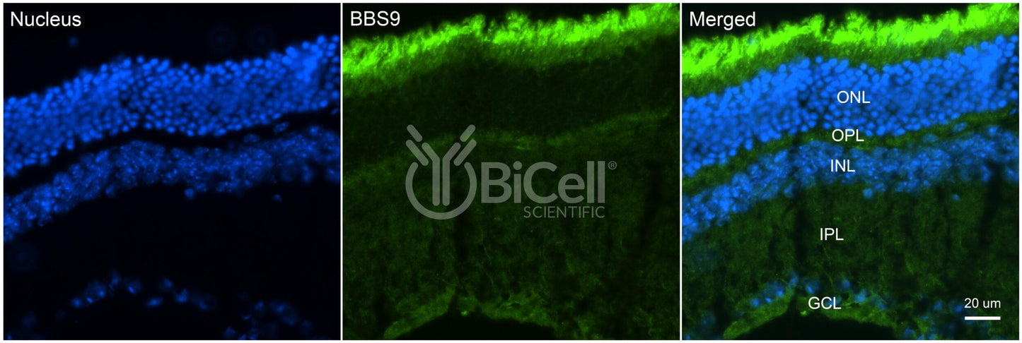 BBS9 (PTHB1) Antibody - Western Blot Validated