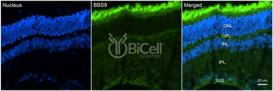 BBS9 (PTHB1) Antibody