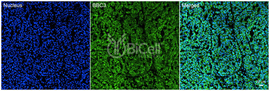 BBC3 (PUMA) Antibody