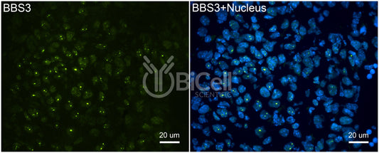 BBS3 (ARL6) Antibody - Western Blot Validated