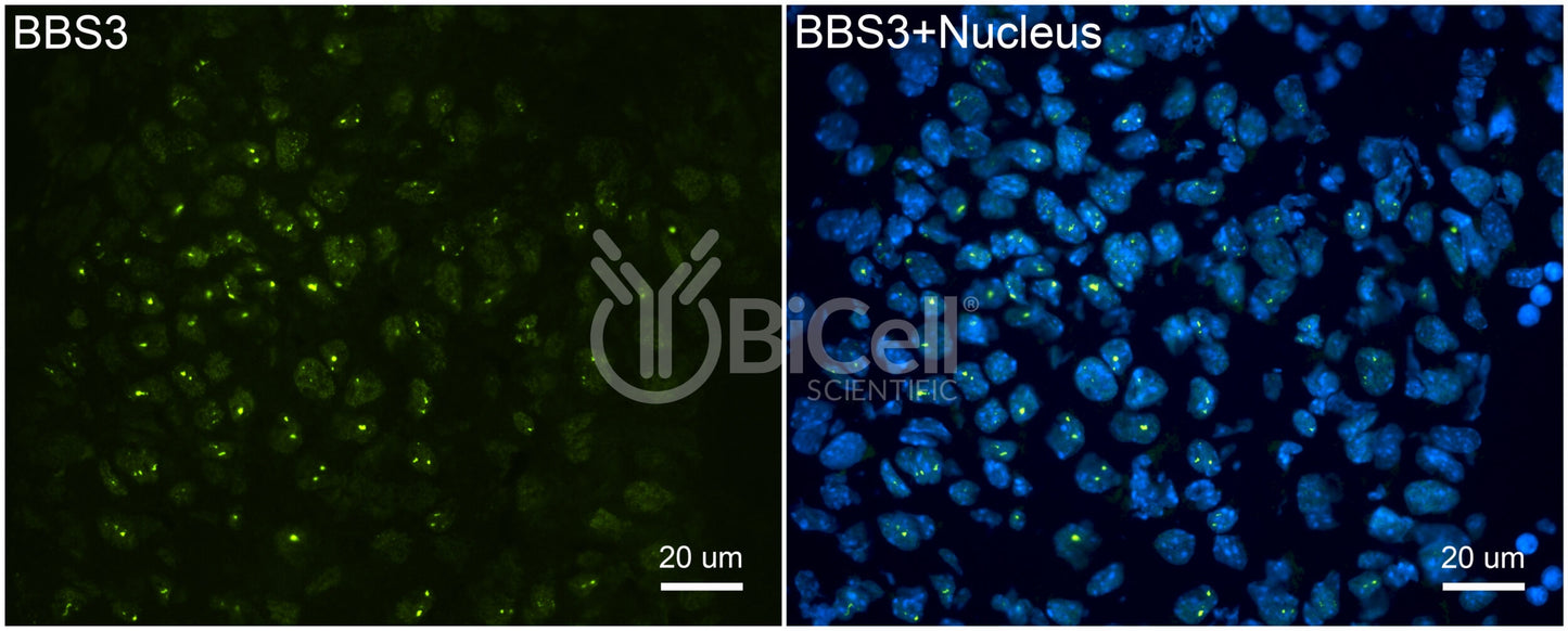 BBS3 (ARL6) Antibody - FFPE Validated
