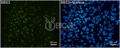 BBS3 (ARL6) Antibody