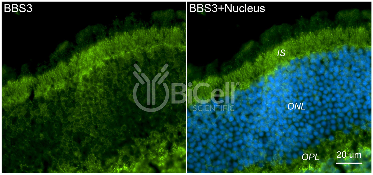 BBS3 (ARL6) Antibody - Western Blot Validated