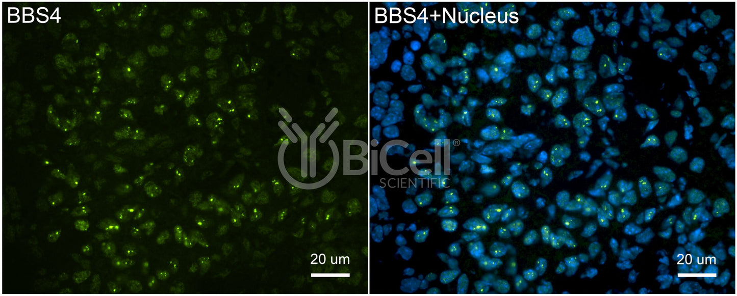 BBS4 Antibody - FFPE Validated