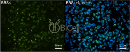 BBS4 Antibody - FFPE Validated