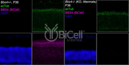 BBS4 Antibody - FFPE Validated