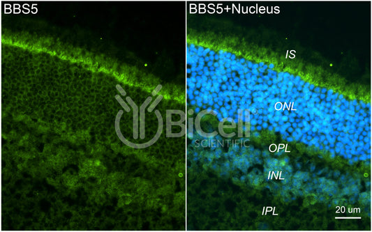 BBS5 (C-Terminus) Antibody - FFPE Validated