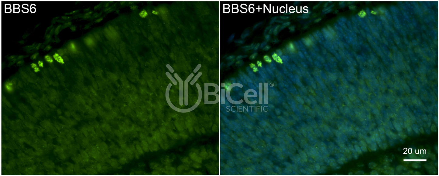 BBS6 Antibody - FFPE Validated