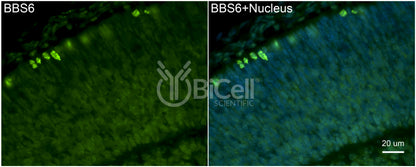 BBS6 Antibody