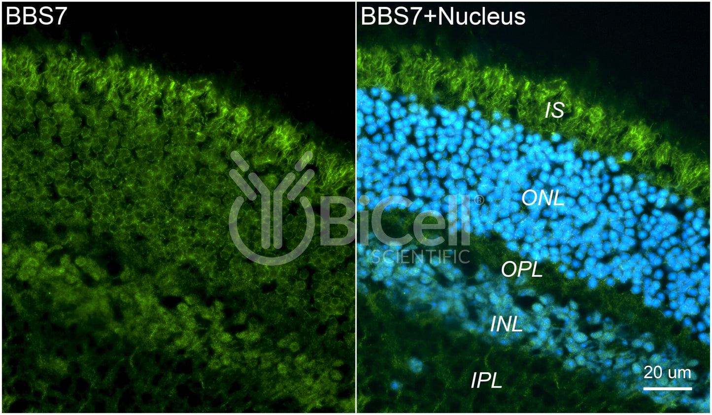 BBS7 Antibody - FFPE Validated
