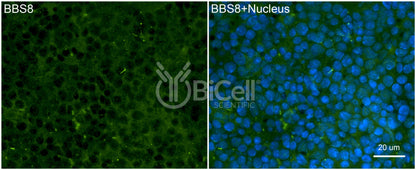BBS8 (TTC8) Antibody - FFPE Validated
