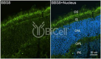 BBS8 (TTC8) Antibody - FFPE Validated