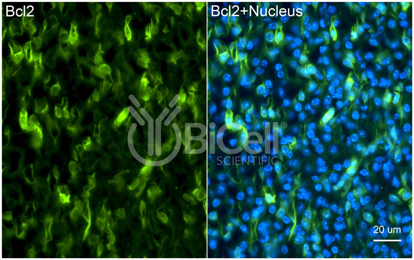 BCL2 Antibody - FFPE Validated