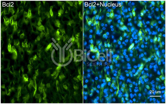 BCL2 Antibody