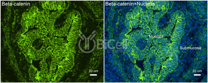 Beta-catenin (Ctnnb1) Antibody