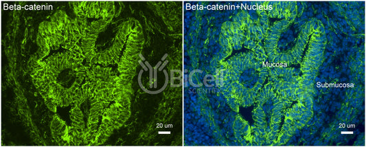 Beta-catenin (Ctnnb1) Antibody