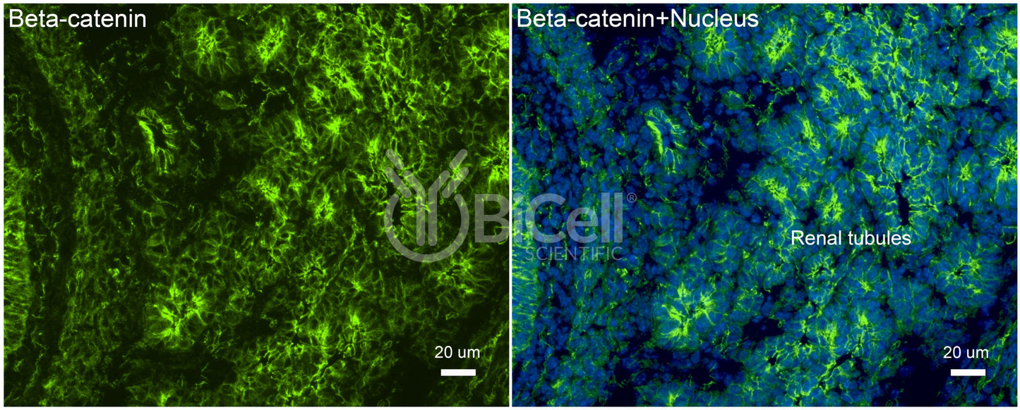 Beta-catenin (Ctnnb1) Antibody - Western Blot Validated