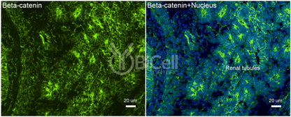 Beta-catenin (Ctnnb1) Antibody